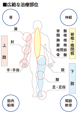 広範な治療部位