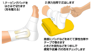 スポーツ外傷の応急処置 日本整形外科学会 症状 病気をしらべる