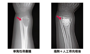 治療