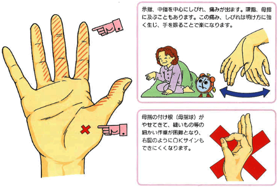 指 が 病気 つる 手 前兆 の 足の指がつる4つの原因&治し方｜癖になる・病気の前兆ってホント？