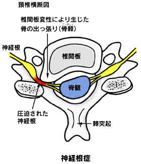 頚椎横断図