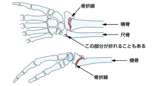 名前 手首 骨