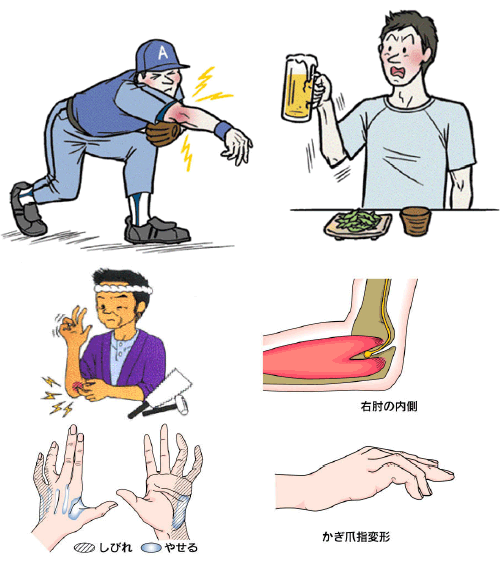 が 痛い 左腕 腕の痛みの原因は？部位でわかる疾患とその対処