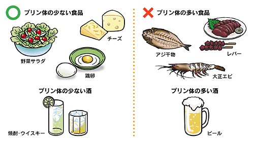 痛風 日本整形外科学会 症状 病気をしらべる