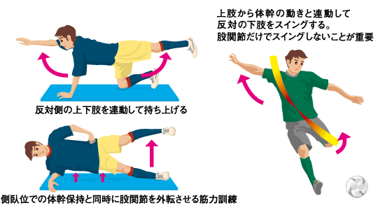 鼠径部痛症候群の治療