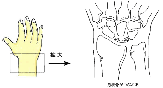 原因と病態