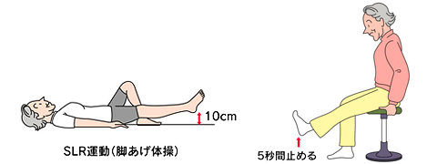 変形性膝関節症の予防