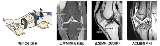 膝靭帯損傷 日本整形外科学会 症状 病気をしらべる