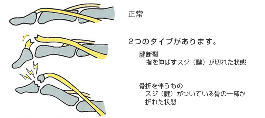 病態