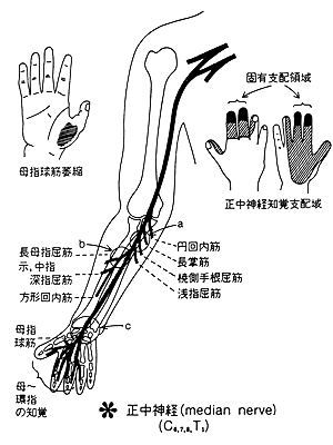 正中神経麻痺 日本整形外科学会 症状 病気をしらべる