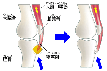 é¢é£ç»å