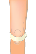 大腿四頭筋のストレッチング