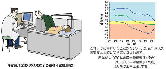 診断