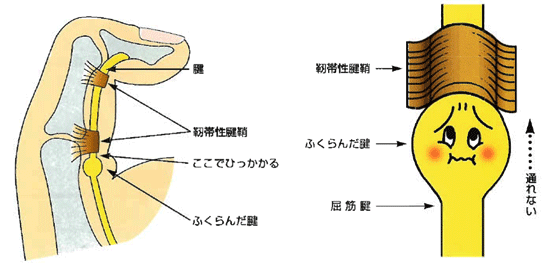 病態