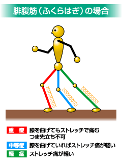 肉離れ 日本整形外科学会 症状 病気をしらべる