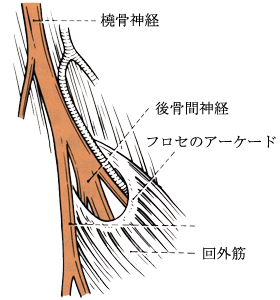 フロセのアーケード