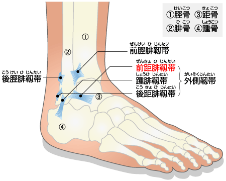 足関節捻挫 日本整形外科学会 症状 病気をしらべる