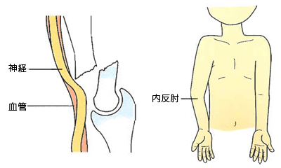 合併症